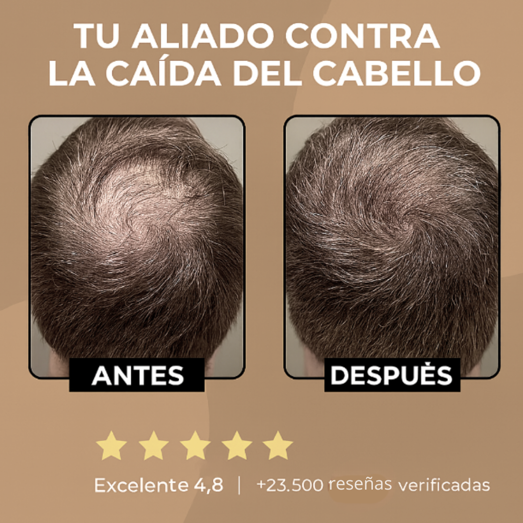 CLEVIRA TITAN™ Champú Activador de Raíces para Hombres contra la Caída del Cabello – Mayor crecimiento del cabello con solo 4 lavados a la semana