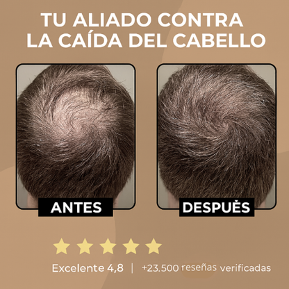 CLEVIRA TITAN™ Champú Activador de Raíces para Hombres contra la Caída del Cabello – Mayor crecimiento del cabello con solo 4 lavados a la semana