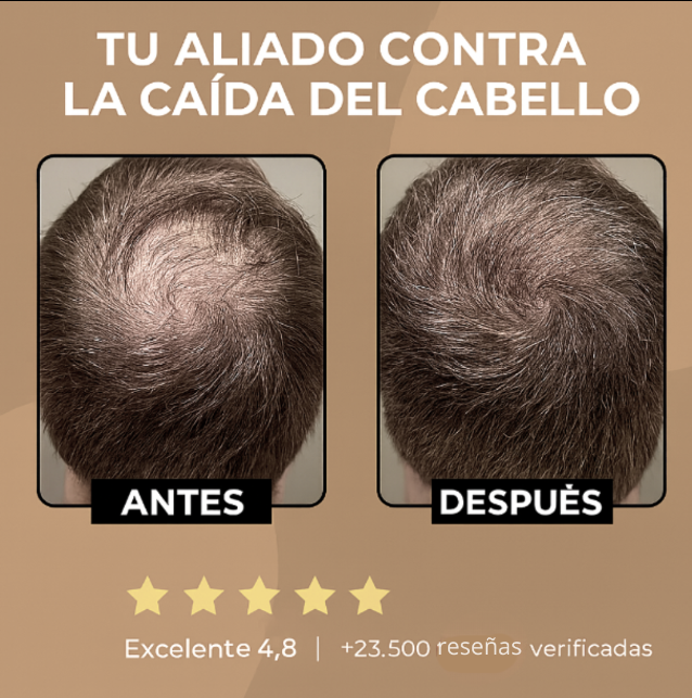 CLEVIRA TITAN™ Champú Activador de Raíces para Hombres contra la Caída del Cabello – Mayor crecimiento del cabello con solo 4 lavados a la semana